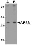 Western blot - AP3S1 Antibody from Signalway Antibody (25323) - Antibodies.com