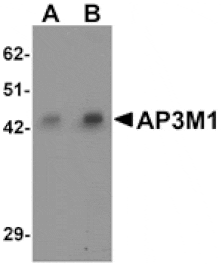 Western blot - AP3M1 Antibody from Signalway Antibody (25324) - Antibodies.com