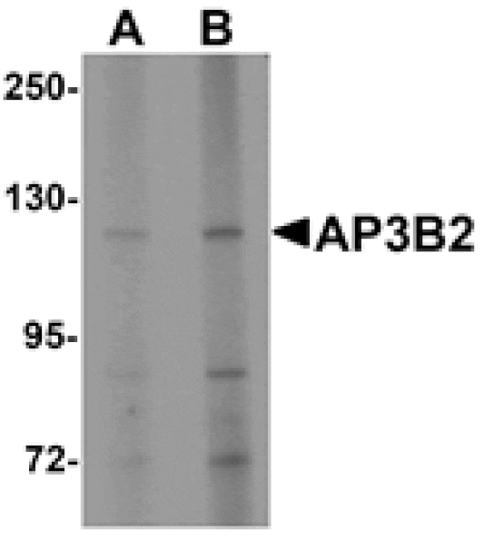 Western blot - AP3B2 Antibody from Signalway Antibody (25325) - Antibodies.com