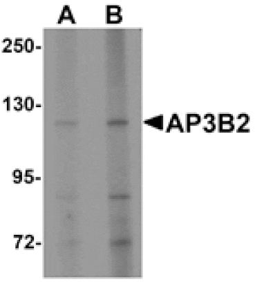 Western blot - AP3B2 Antibody from Signalway Antibody (25325) - Antibodies.com