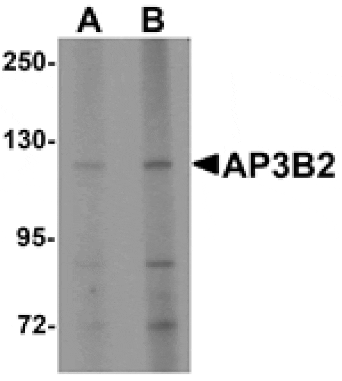 Western blot - AP3B2 Antibody from Signalway Antibody (25325) - Antibodies.com