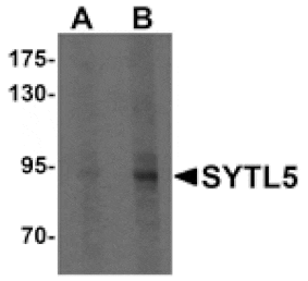 Western blot - SYTL5 Antibody from Signalway Antibody (25333) - Antibodies.com
