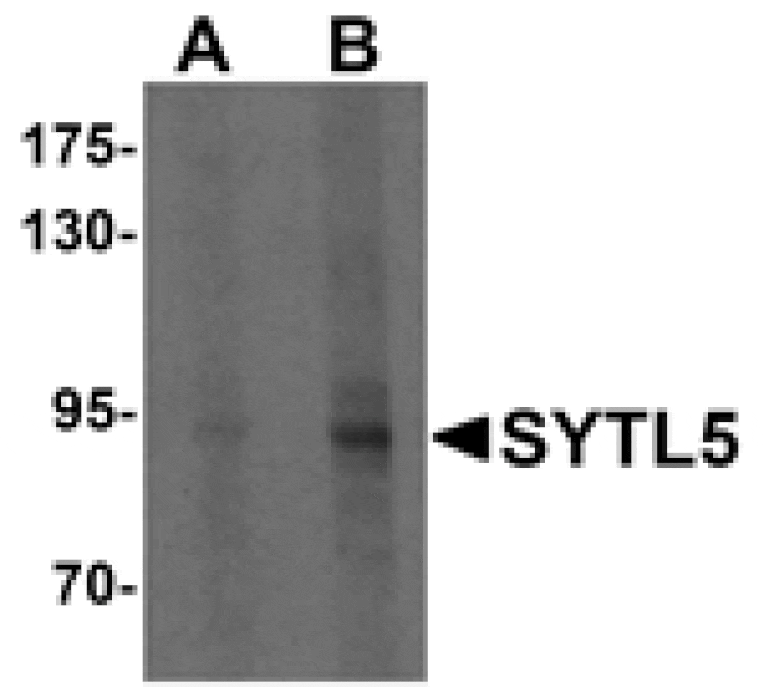 Western blot - SYTL5 Antibody from Signalway Antibody (25333) - Antibodies.com