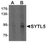 Western blot - SYTL5 Antibody from Signalway Antibody (25333) - Antibodies.com