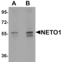 Western blot - NETO1 Antibody from Signalway Antibody (25351) - Antibodies.com