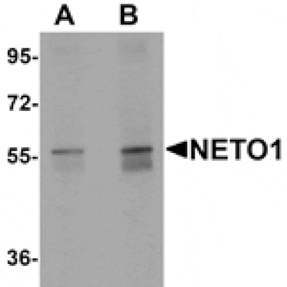 Western blot - NETO1 Antibody from Signalway Antibody (25351) - Antibodies.com