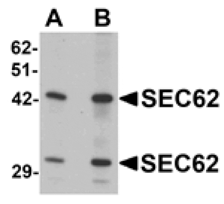 Western blot - SEC62 Antibody from Signalway Antibody (25352) - Antibodies.com