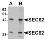 Western blot - SEC62 Antibody from Signalway Antibody (25352) - Antibodies.com