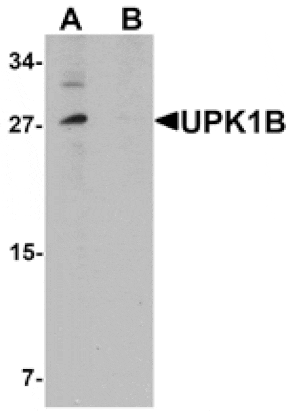 Western blot - UPK1B Antibody from Signalway Antibody (25362) - Antibodies.com