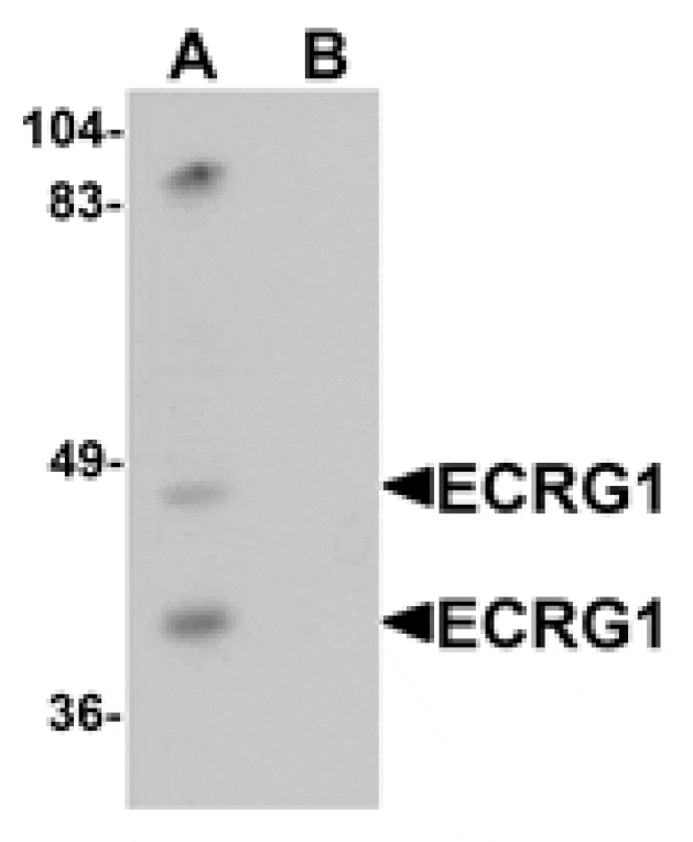 Western blot - ECRG1 Antibody from Signalway Antibody (25367) - Antibodies.com