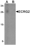 Western blot - ECRG2 Antibody from Signalway Antibody (25368) - Antibodies.com