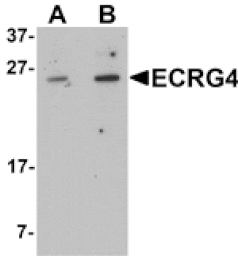 Western blot - ECRG4 Antibody from Signalway Antibody (25369) - Antibodies.com