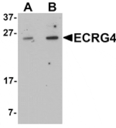 Western blot - ECRG4 Antibody from Signalway Antibody (25369) - Antibodies.com