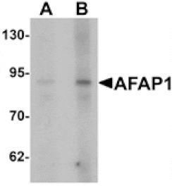 Western blot - AFAP1 Antibody from Signalway Antibody (25380) - Antibodies.com