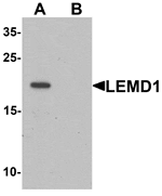 Western blot analysis of LEMD1 in A20 cell lysate with LEMD1 antibody at 1 µg/mL in (A) the absence and (B) the presence of blocking peptide.
