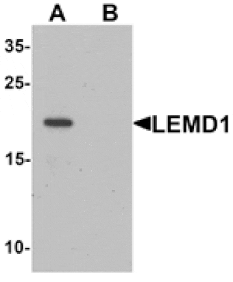 Western blot - LEMD1 Antibody from Signalway Antibody (25388) - Antibodies.com