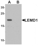 Western blot - LEMD1 Antibody from Signalway Antibody (25388) - Antibodies.com