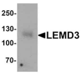 Western blot - LEMD3 Antibody from Signalway Antibody (25389) - Antibodies.com