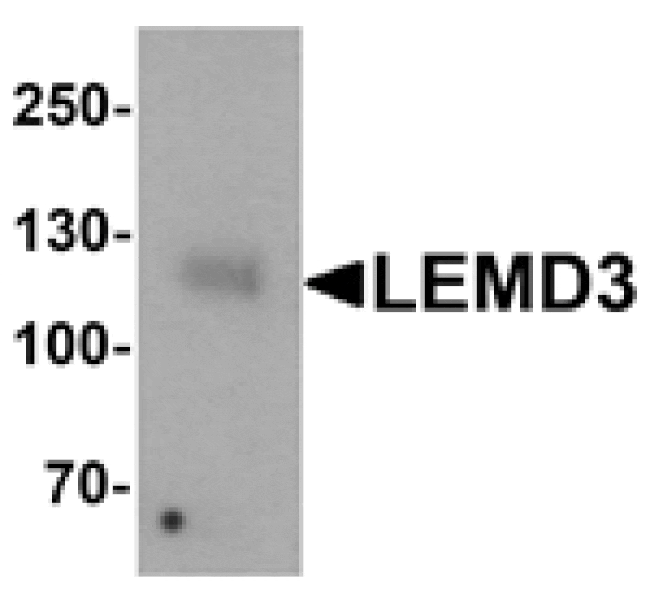 Western blot - LEMD3 Antibody from Signalway Antibody (25389) - Antibodies.com