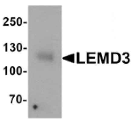 Western blot - LEMD3 Antibody from Signalway Antibody (25389) - Antibodies.com