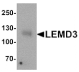 Western blot - LEMD3 Antibody from Signalway Antibody (25389) - Antibodies.com