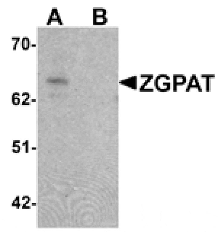 Western blot - ZGPAT Antibody from Signalway Antibody (25393) - Antibodies.com