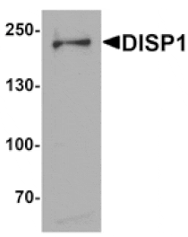 Western blot - DISP1 Antibody from Signalway Antibody (25400) - Antibodies.com