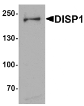 Western blot - DISP1 Antibody from Signalway Antibody (25400) - Antibodies.com