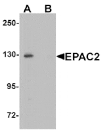 Western blot - EPAC2 Antibody from Signalway Antibody (25402) - Antibodies.com