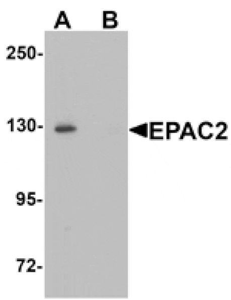Western blot - EPAC2 Antibody from Signalway Antibody (25402) - Antibodies.com