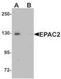 Western blot - EPAC2 Antibody from Signalway Antibody (25402) - Antibodies.com