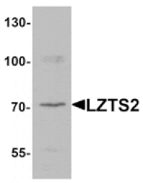 Western blot - LZTS2 Antibody from Signalway Antibody (25403) - Antibodies.com