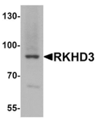 Western blot - RKHD3 Antibody from Signalway Antibody (25405) - Antibodies.com