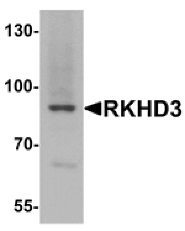 Western blot - RKHD3 Antibody from Signalway Antibody (25405) - Antibodies.com