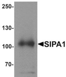 Western blot - SIPA1 Antibody from Signalway Antibody (25406) - Antibodies.com