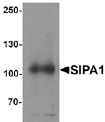 Western blot - SIPA1 Antibody from Signalway Antibody (25406) - Antibodies.com