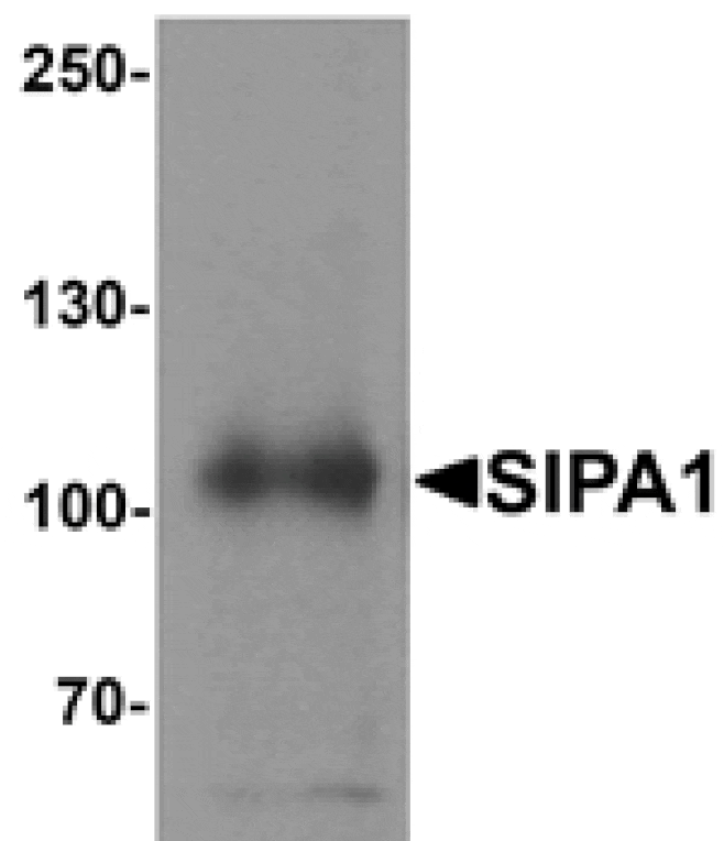 Western blot - SIPA1 Antibody from Signalway Antibody (25406) - Antibodies.com