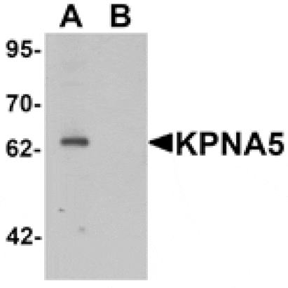 Western blot - KPNA5 Antibody from Signalway Antibody (25411) - Antibodies.com