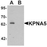 Western blot - KPNA5 Antibody from Signalway Antibody (25411) - Antibodies.com
