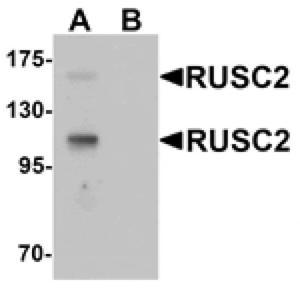 Western blot - RUSC2 Antibody from Signalway Antibody (25413) - Antibodies.com