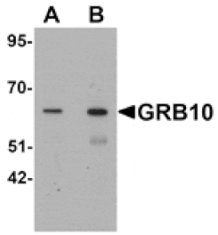 Western blot - GRB10 Antibody from Signalway Antibody (25427) - Antibodies.com