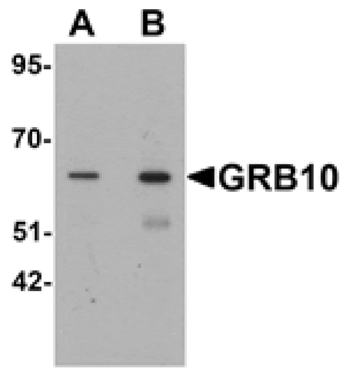 Western blot - GRB10 Antibody from Signalway Antibody (25427) - Antibodies.com