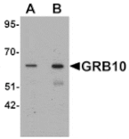 Western blot - GRB10 Antibody from Signalway Antibody (25427) - Antibodies.com