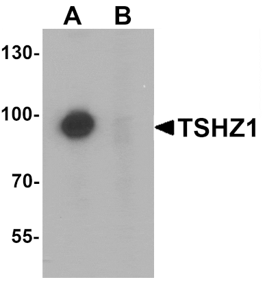 Western blot - TSHZ1 Antibody from Signalway Antibody (25457) - Antibodies.com