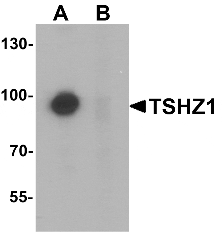 Western blot - TSHZ1 Antibody from Signalway Antibody (25457) - Antibodies.com
