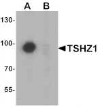 Western blot - TSHZ1 Antibody from Signalway Antibody (25457) - Antibodies.com