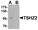 Western blot analysis of TSHZ2 in A-20 cell lysate with TSHZ2 antibody at 1 µg/mL in (A) the absence and (B) the presence of blocking peptide.