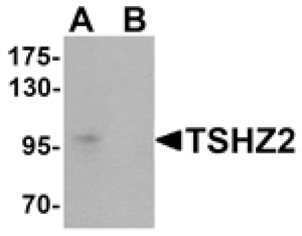 Western blot - TSHZ2 Antibody from Signalway Antibody (25458) - Antibodies.com