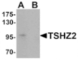 Western blot - TSHZ2 Antibody from Signalway Antibody (25458) - Antibodies.com