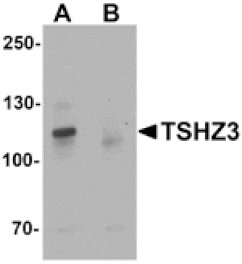 Western blot - TSHZ3 Antibody from Signalway Antibody (25459) - Antibodies.com